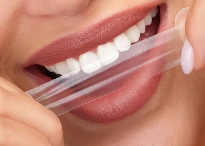 Hello Smile Trakice Za Izbjeljivanje Zuba 14 komada - Slika 2