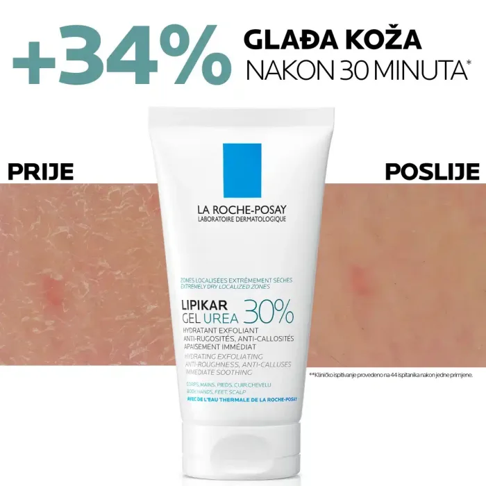La Roche-Posay LIPIKAR gel s 30% uree za ciljanu primjenu na suha i gruba područja kože, 50ml - Image 6